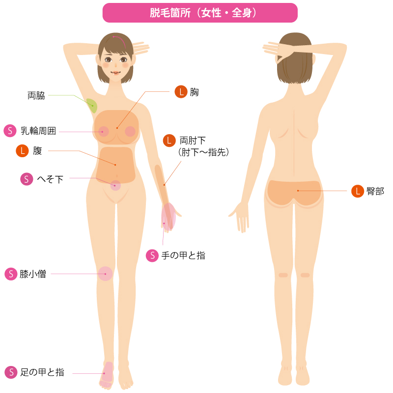 IPL脱毛　全身
